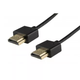 SOMOGYI HDMI KÁBEL 1M HDS1
